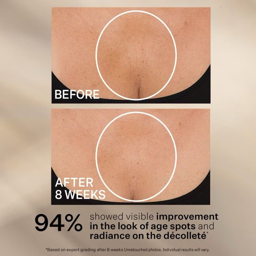 StriVectin - TL Advanced Tightening Neck Cream Plus + - $100 - Brand New! - Picture 6 of 7